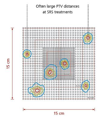 OCTAVIUS Detector 1600 MR: multi target SRS treatments