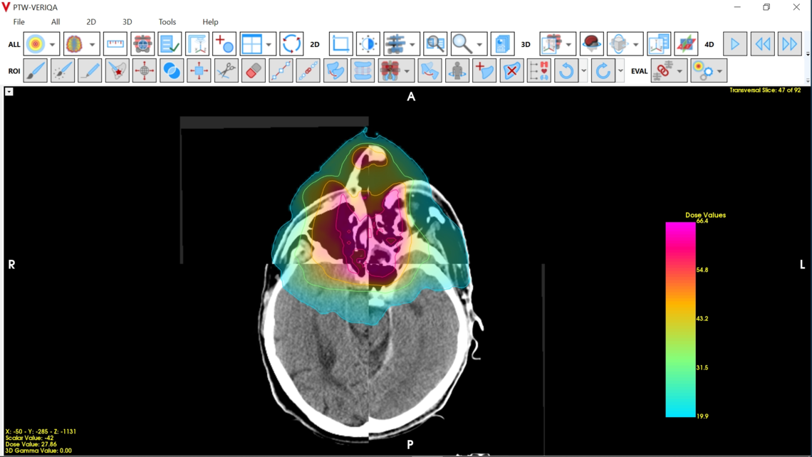 VERIQA visualization tools for plan review: overlayed view for image registration