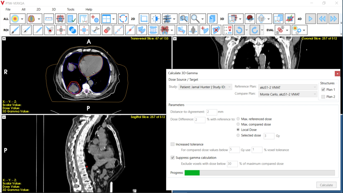 VERIQA visualization tools for plan review: calculation and analysis of 3D gamma-index