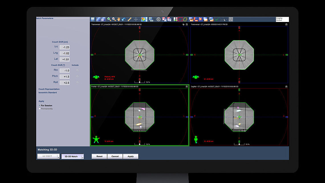 LINAC QA Alignment errors detected using CBCT images generated by VARIAN TrueBeam system