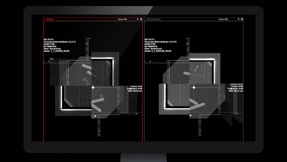 LINAC QA Fusion of RUBY DRR and portal (MV) images: The LINAC QA insert is clearly visible on the MV image. The DRR image can be fused with the MV image to detect alignment errors. 