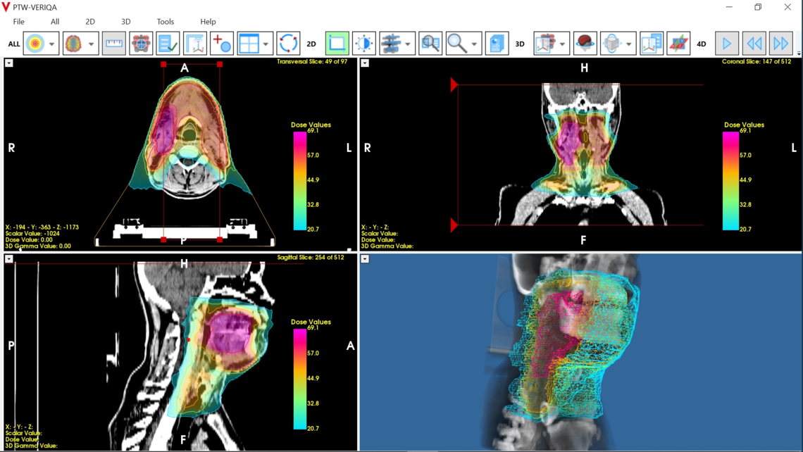 VERIQA visualization tools for plan review: volume cropping