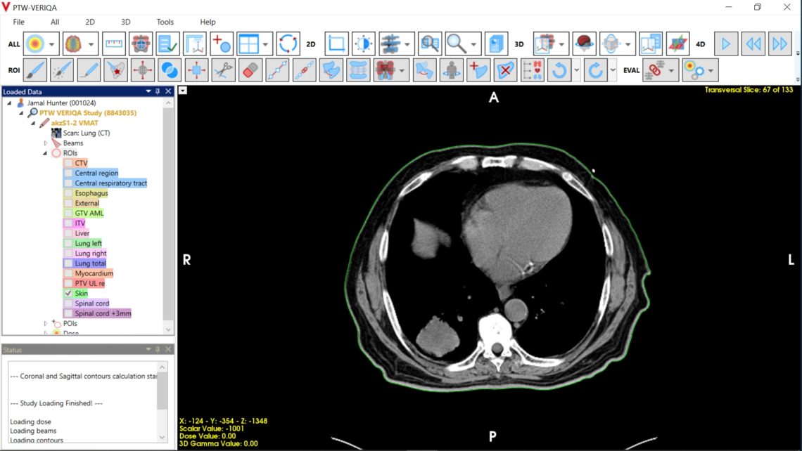 VERIQA visualization tools for plan review: auto creation of body contours