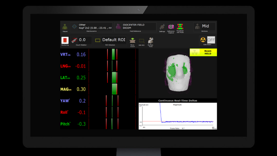 RUBY head phantom: Monitored by Vision-RT surface guided system. Aligned after CBCT imaging.