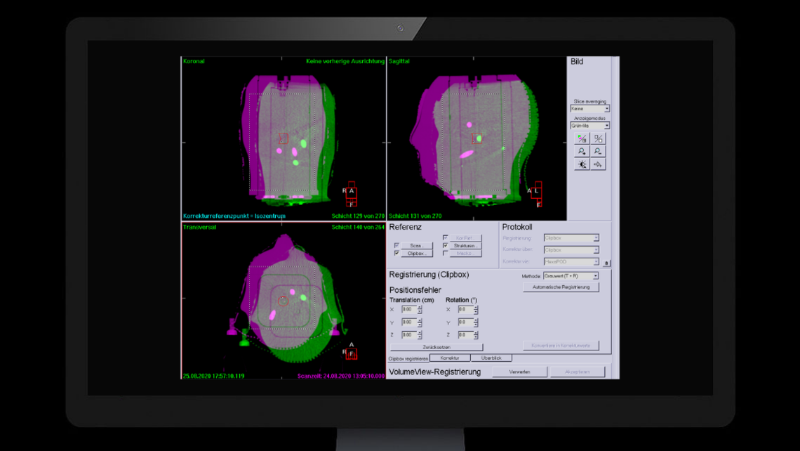 RUBY head phantom: CBCT imaging using Elekta XVI software of RUBY head phantom with System QA MultiMet insert.